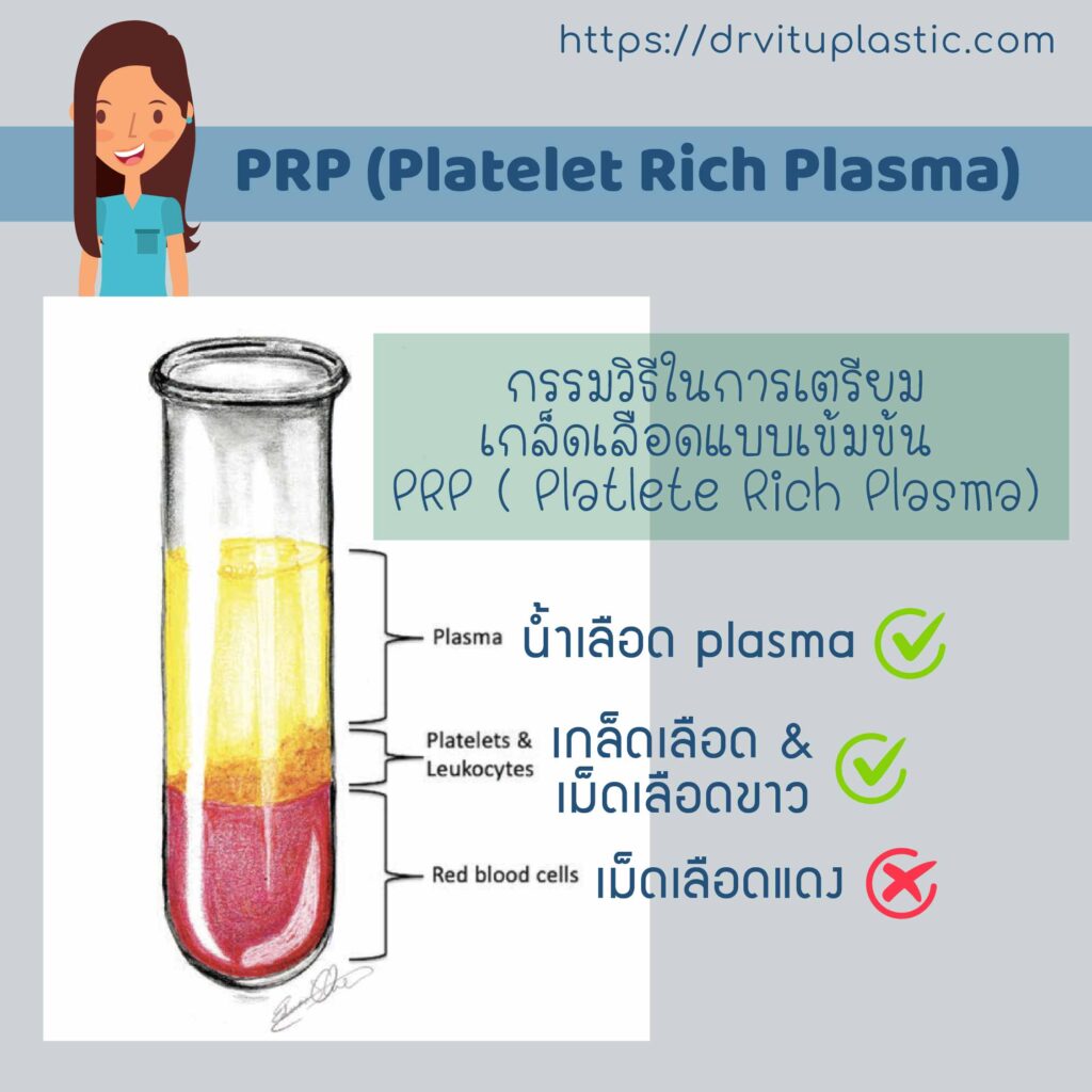 PRP Platelet rich plasma คืออะไร