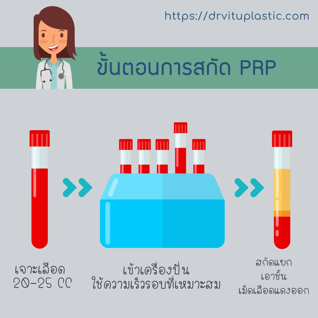 PRPคืออะไร